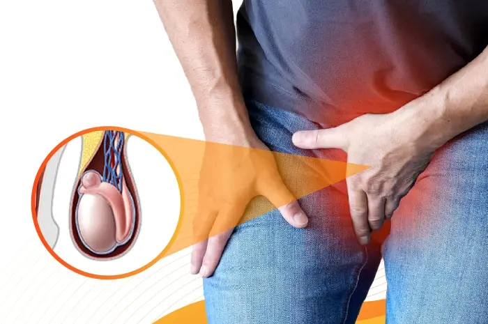 Natural Remedies for Getting Rid of a Spermatocele